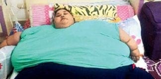 La donna più pesante del mondo ha perso 250 chili in clinica