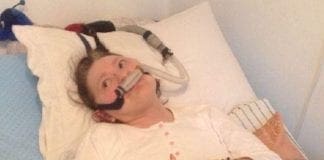 Addio a Giovanna Romanato, la sampdoriana che viveva in polmone d’acciaio