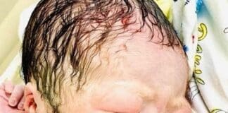 Bimbo nato con la spirale in mano, la foto fa il giro dei social ma è una bufala