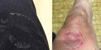 Marassi, detenuto aggredisce e morde due agenti della Penitenziaria