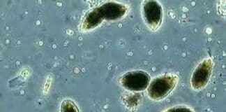 Genova, alga tossica fiorisce in mare, scatta allarme Arpal ostreopsis ovata alga tossica mare ligure