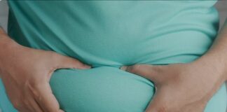 Salute, al Galliera di Genova un team contro l’obesità obeso obesità