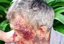 Taggia, anziano ferito trovato in strada, appello ai testimoni anziano ferito Taggia