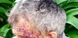 Taggia, anziano ferito trovato in strada, appello ai testimoni anziano ferito Taggia